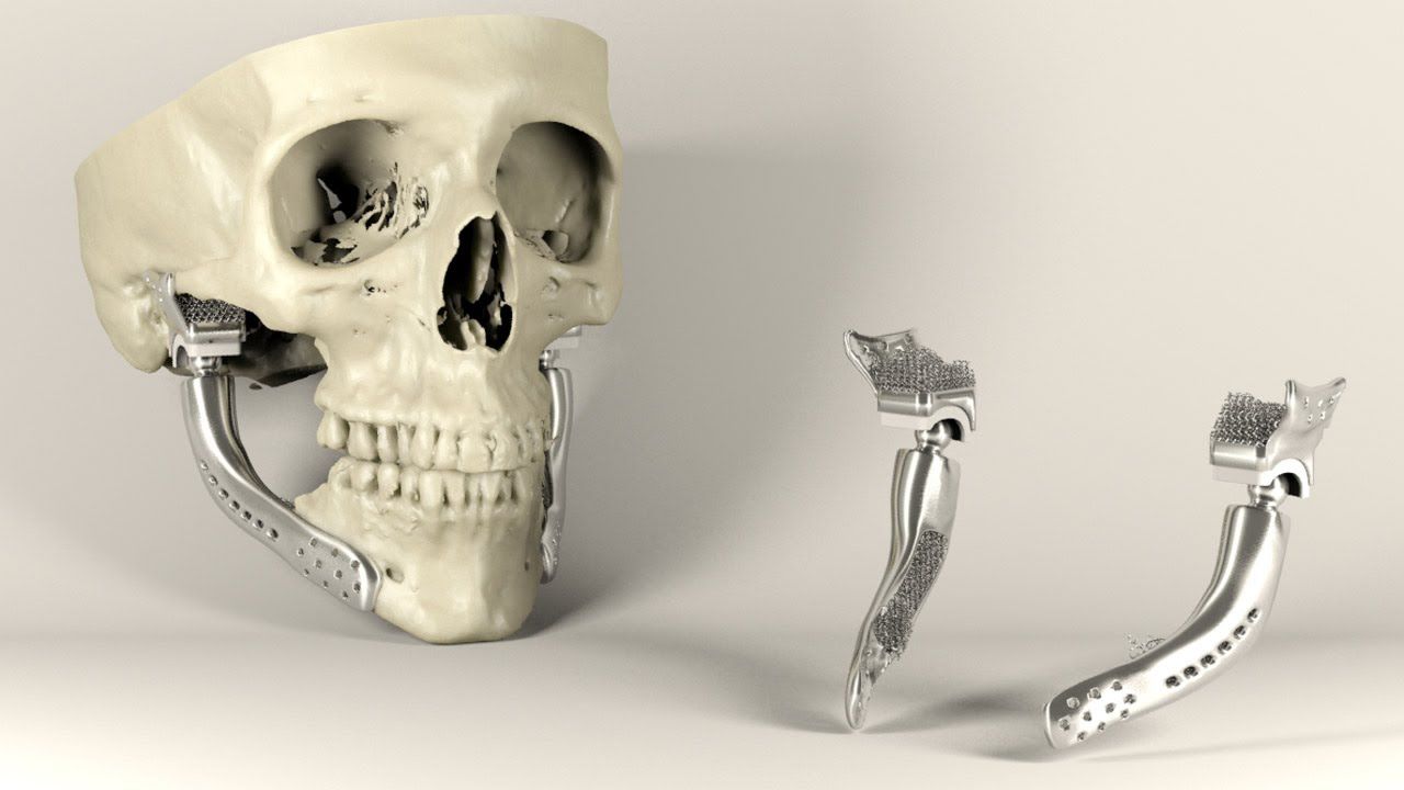 How 3d printing works in the healthcare!!